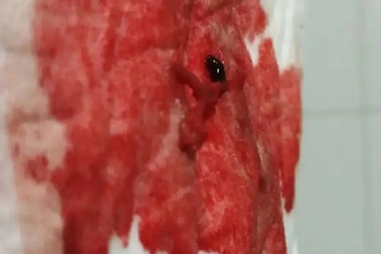 月经与出血的区别图片