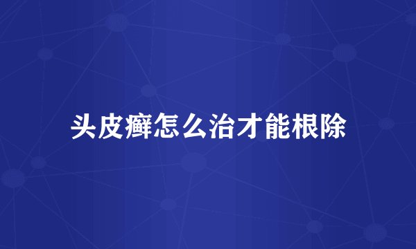 头皮癣怎么治才能根除