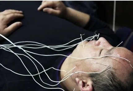 女子针灸电疗瘫痪是怎么回事?