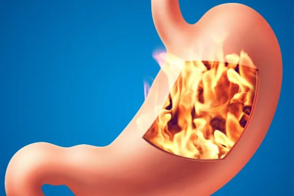 胃的拼音怎么写的拼音