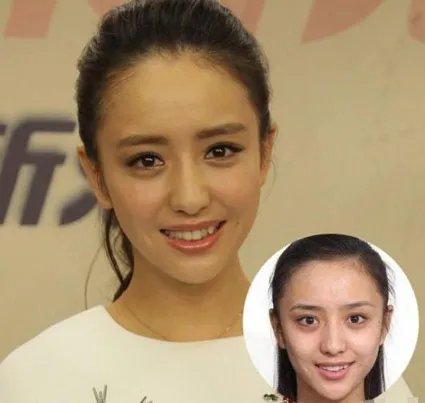 佟丽娅整容前后大对比 整容前17岁照片差别大