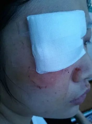 成都护士为什么被患者家属打伤？