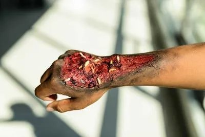 高压线触电的原理  高压触电急救方法