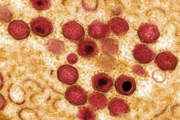 双汇回应非洲猪瘟：什么是非洲猪瘟?危害有哪些