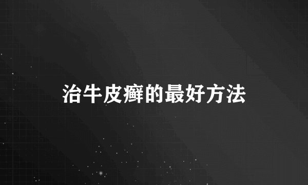 治牛皮癣的最好方法
