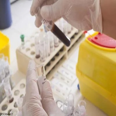 做胃镜是怎么做 曝光做胃镜的4个步骤