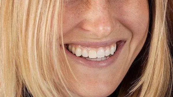 牙龈肿疼吃什么药