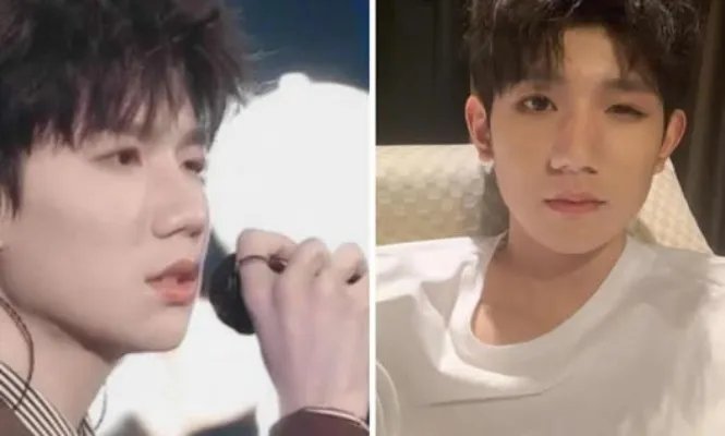 王源回应眼睛被咬具体什么情况:为什么被咬图片曝光