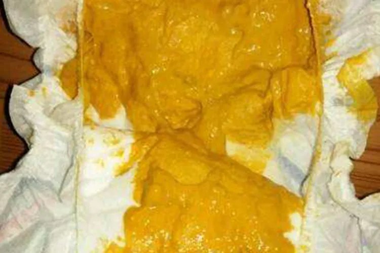 新生儿正常大便图片