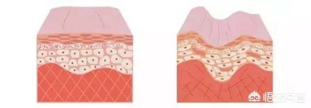 美容仪真的有返老还童的效果吗？