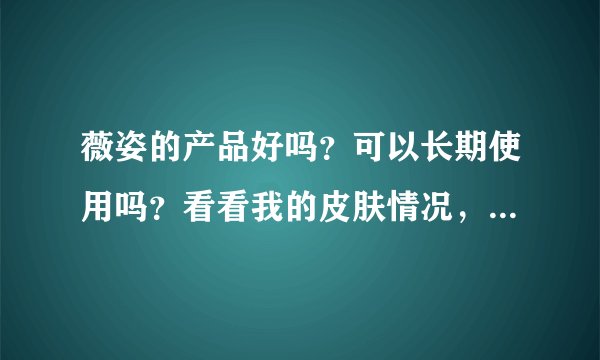 薇姿的产品好吗？可以长期使用吗？看看我的皮肤情况，还有更适合我的产品吗？