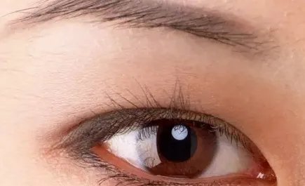 做双眼皮埋线一般多少钱啊