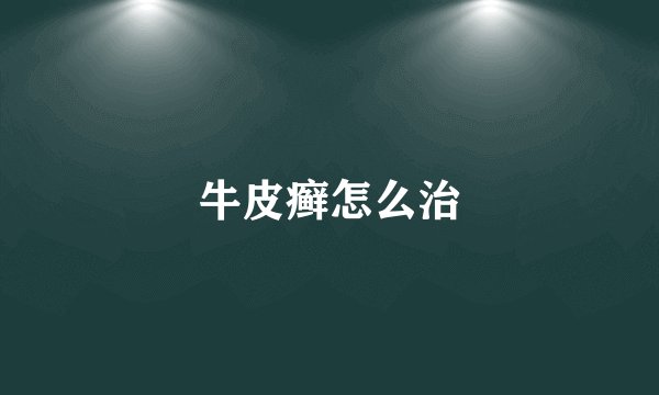 牛皮癣怎么治