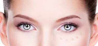 上睑下垂矫正术注意事项