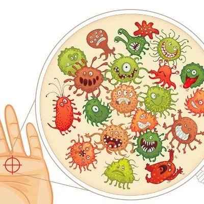 牛皮癣的治疗偏方是什么