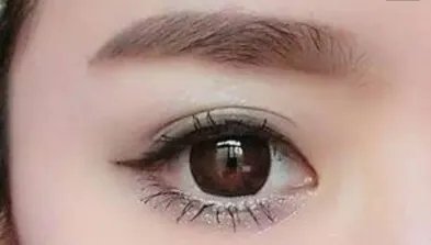 做微创双眼皮医院哪里好