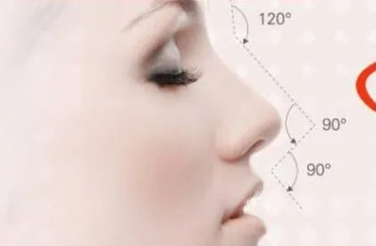 做鼻中隔软骨隆鼻一般多少钱