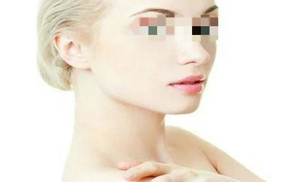 光子嫩肤美白多少钱